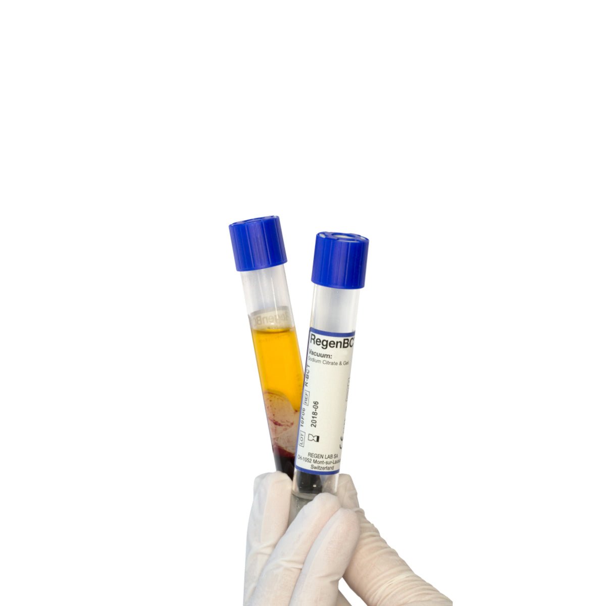 PRP preparation tubes — illustrative image